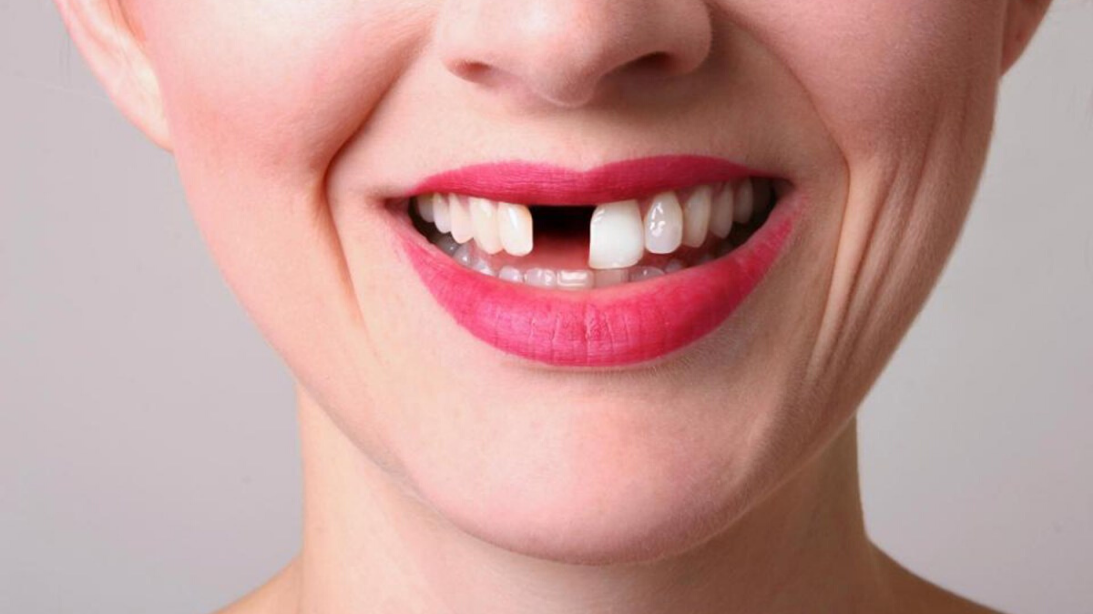 tooth loss and warning signs